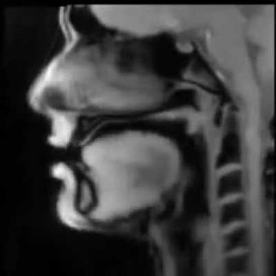Real-time MRI lets you see the movements of the mouth and throat of a man speaking (originally recorded and published by Jens Frahm, Max-Planck-Institute G&ouml;ttingen)