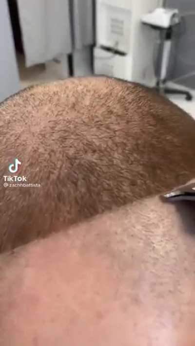 Just make a feature of my receding hairline