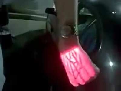 Localizador de veias, s&atilde;o aparelhos que usam luz infravermelha para procurar veias, existem em varias cores e formatos para se adequar a cada situa&ccedil;&atilde;o e paciente.