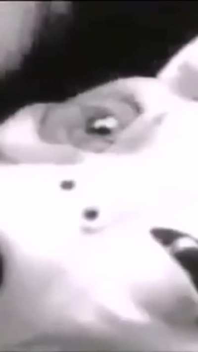 To the person that said Grey's black eyes are just "lenses", I found that old video of them being removed!