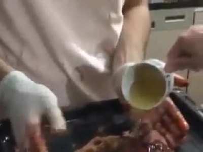 El &Ccedil;iğ K&ouml;fte BASED