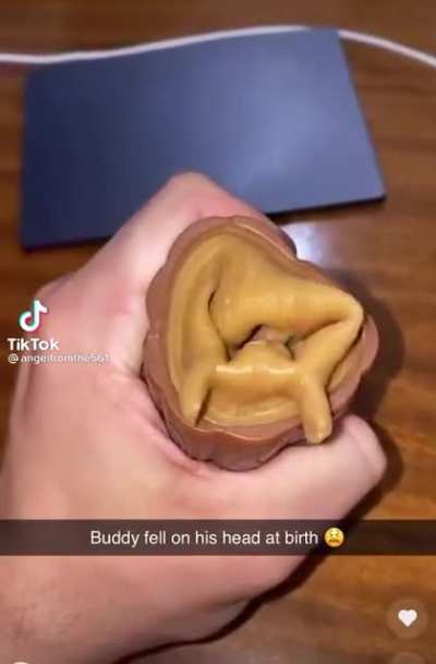 Nuts