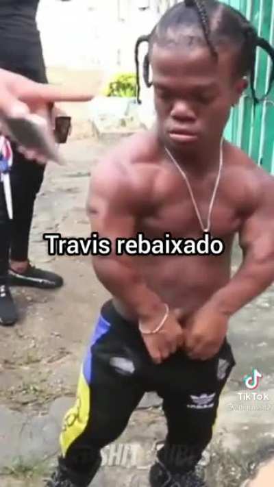 tipos de an&acirc;o