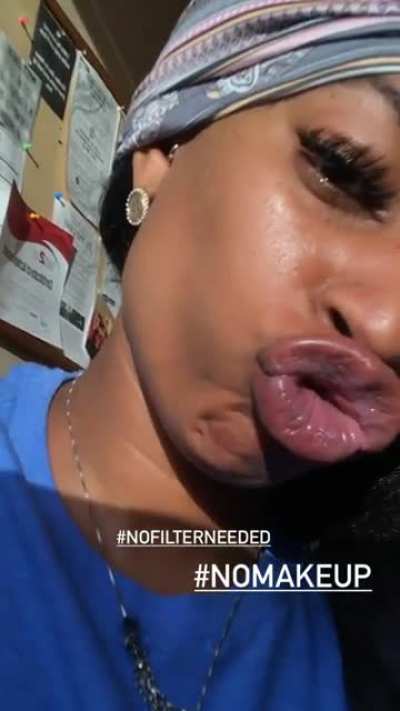 🤕