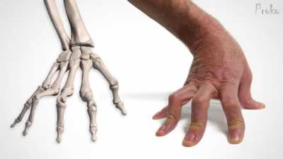 Bones