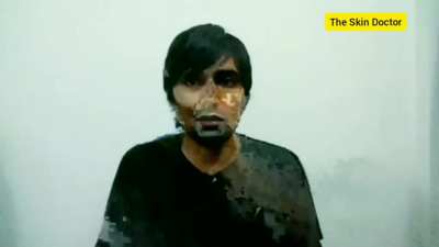 Truth of peta explained by "the skin doctor"