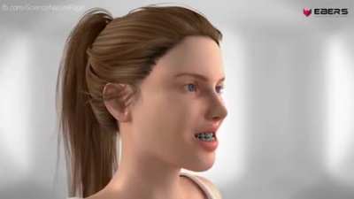 Here's how different types of jaw surgery is carried out!
