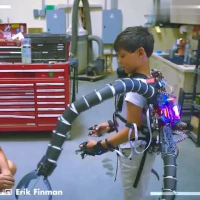 This Dr. Octopus Suit for hypermobility issues