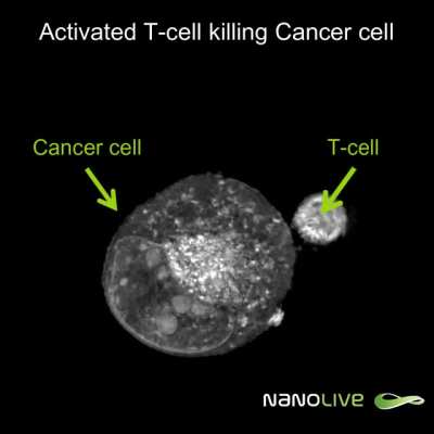 A T cell battling a cancer cell