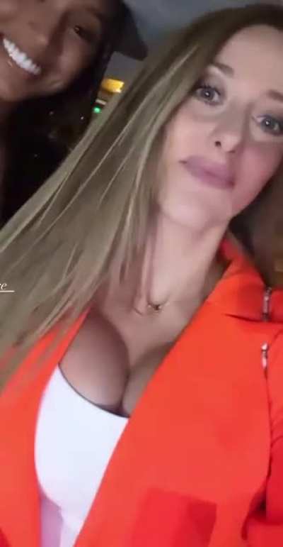 Ig story