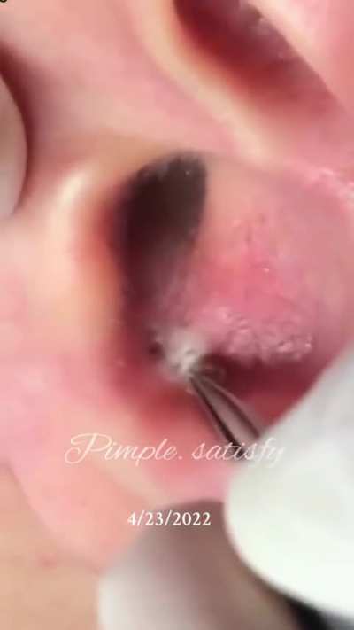 A beautiful release&hellip;