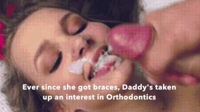 Braces bleached with Daddy&rsquo;s sperm