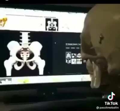 I got a 207th bone!!