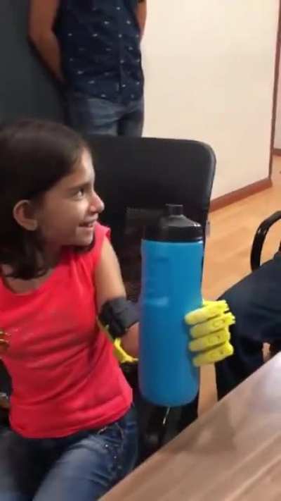 The man that gives the high five is one of my university teachers. For years he&rsquo;s been working towards producing low cost, affordable prosthesis for kids, a couple of weeks ago this girl got the first one.