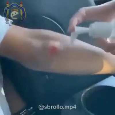 La grasa