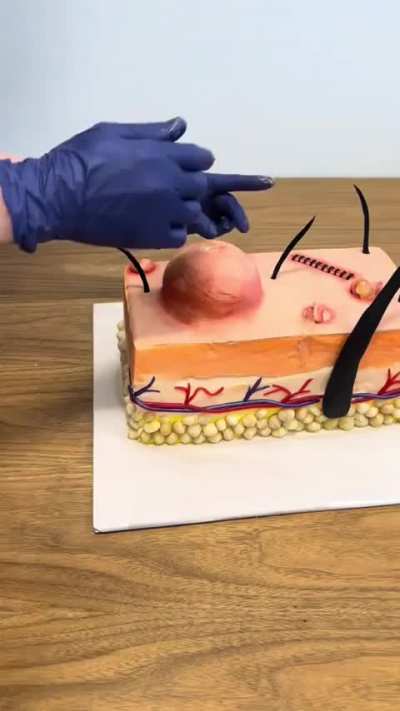A dermatologist&rsquo;s birthday cake
