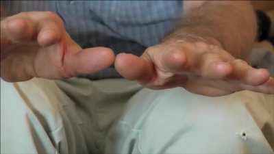Weed+ Parkinson&rsquo;s incredible
