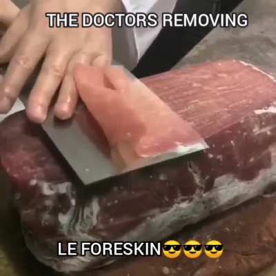 They have safely removed it😎😎😎