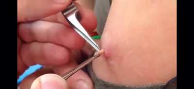 Let&rsquo;s bring back the true pain of this sub. A bit fly extraction