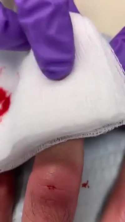 Thanks, I hate recorded nail removing