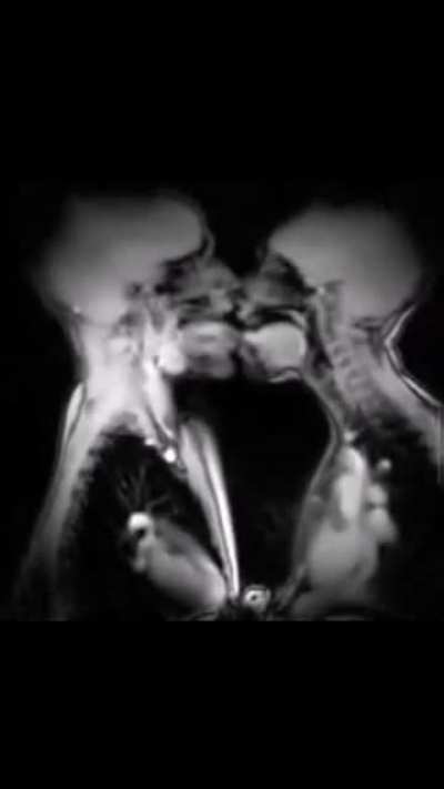 It's just a kiss