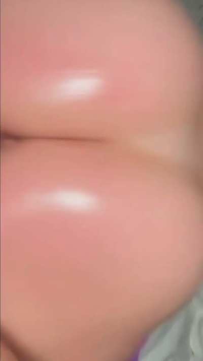 MM