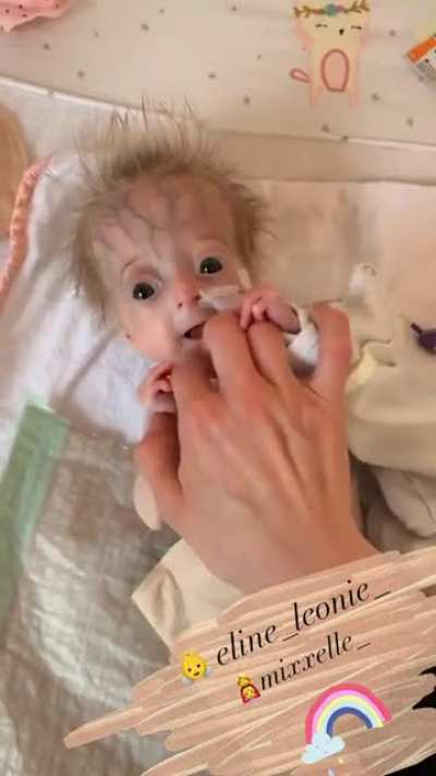 olum bebek &ccedil;ok erken doğmuş