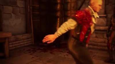 how i wake up after sleeping on my arm