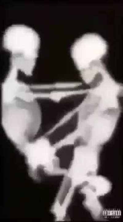 💀