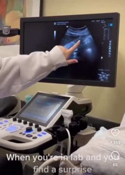 Girl found out she&rsquo;s pregnant during a school lab 💀