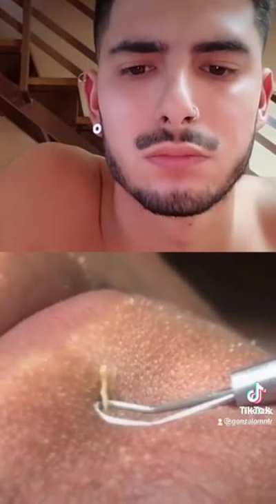 AAAAAAAAAA