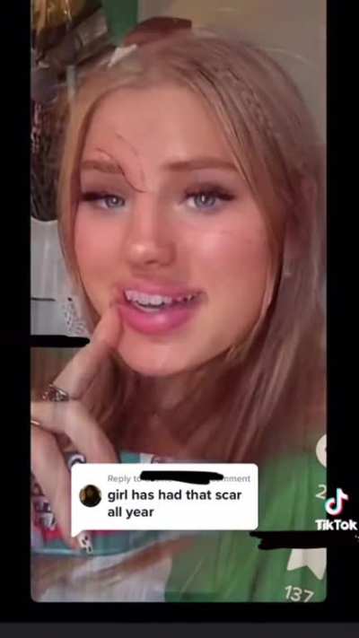 New trend&hellip; fake scars drawn on the face