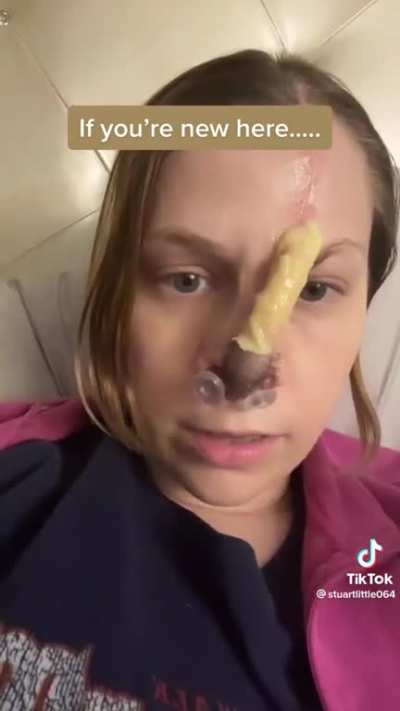 Saw the dissolved septum posts and wanted to share this woman&rsquo;s story. At one point she was snorting up to an ounce of coke a day. Really respect her for sharing her story and being so honest.