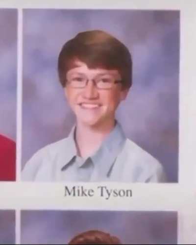 Apparently it's called Micheal Jackson Syndrome