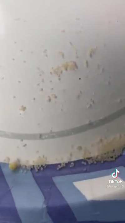 Spider eggs