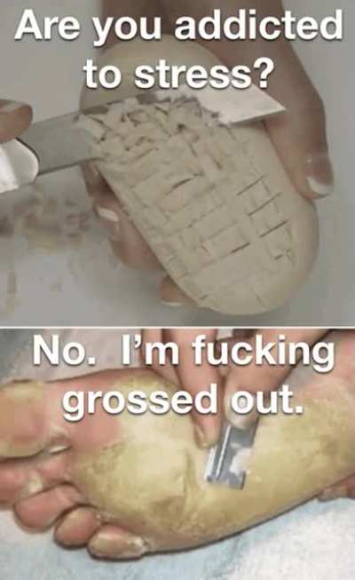 I hate this ad