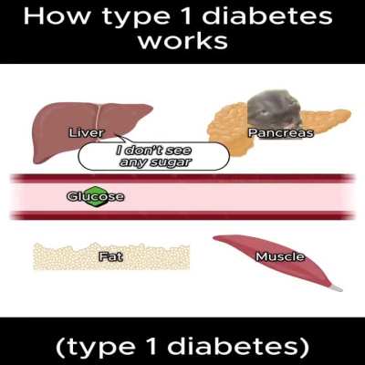 How type 1 diabetes works (found on X)