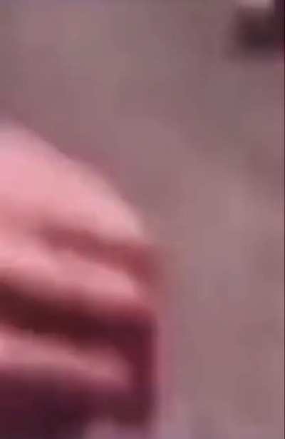 Moldy sunburn