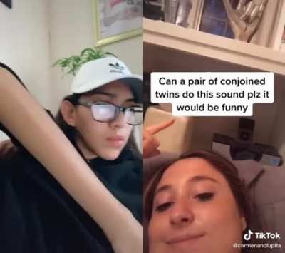 Conjoined twins