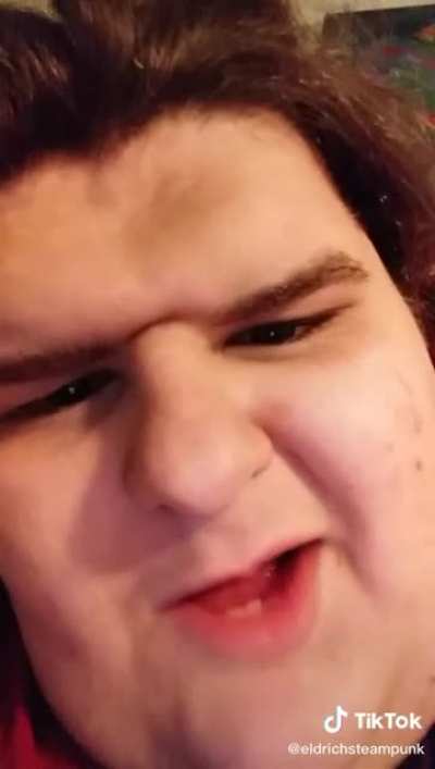 I’ve never seen an ass crease on someone’s forehead?