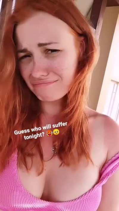 Sunburnt