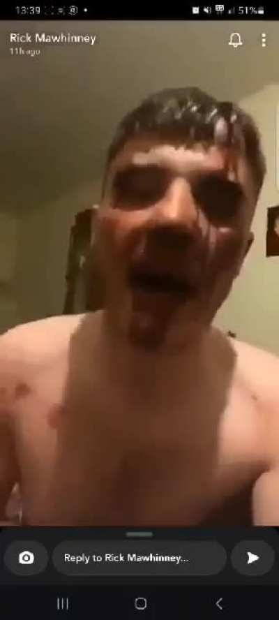 Apparent post or pre knife fight 