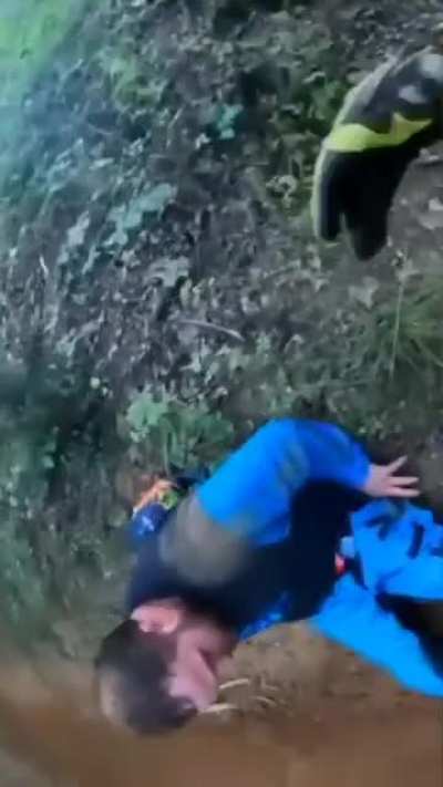 "my leg came off!"