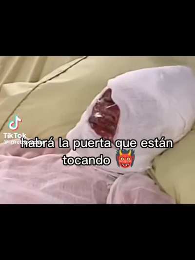 xd